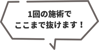 1回の施術でここまで抜けます！